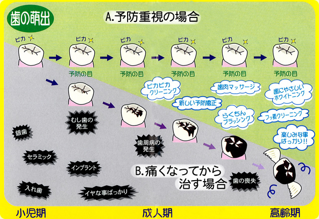 “A or B？”あなたはどちらを選びますか？