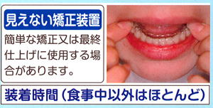 見えない矯正装置